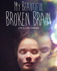 Khối óc xinh đẹp tội nghiệp của tôi - My Beautiful Broken Brain (2016)